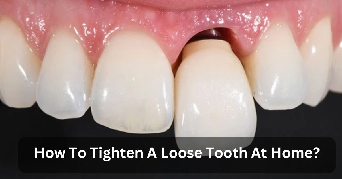 How To Tighten A Loose Tooth At Home